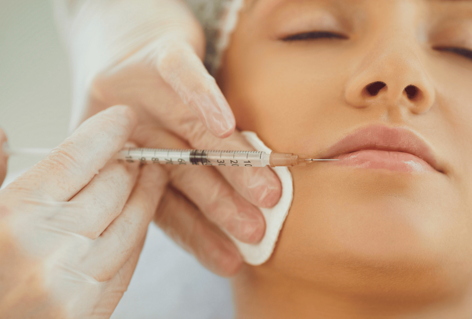 DERMAL FILLERS (2)
