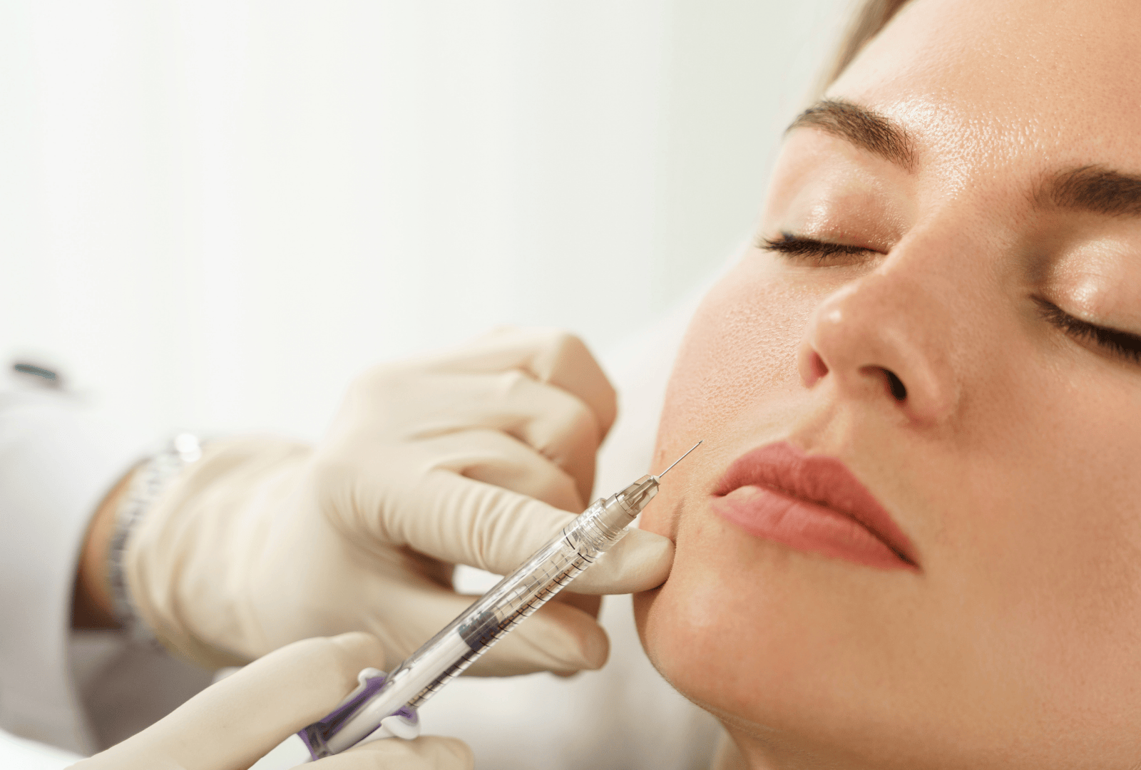 DERMAL FILLERS