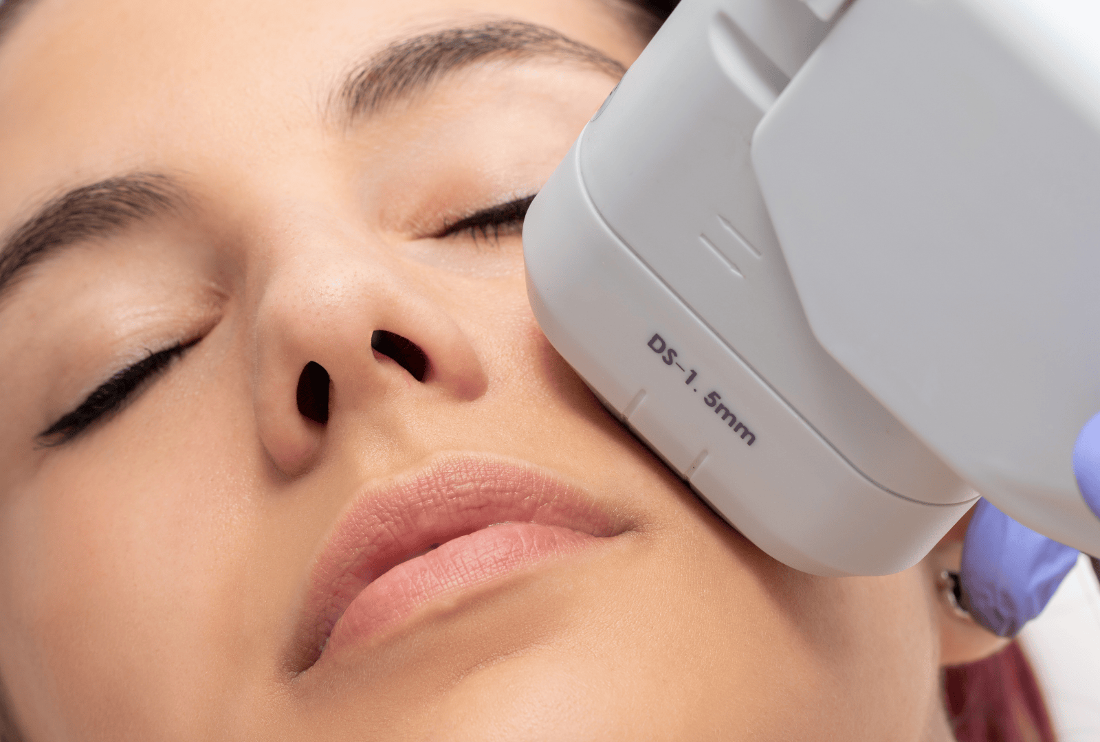 HIGH-INTENSITY SKIN LIGHTENING (2)
