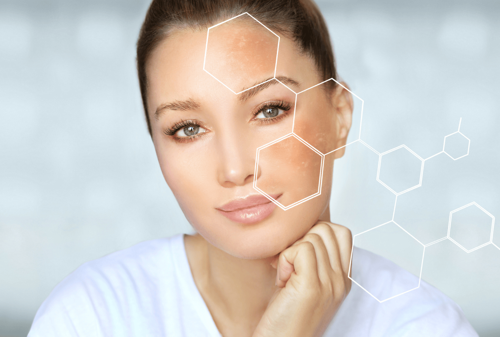 HIGH-INTENSITY SKIN LIGHTENING