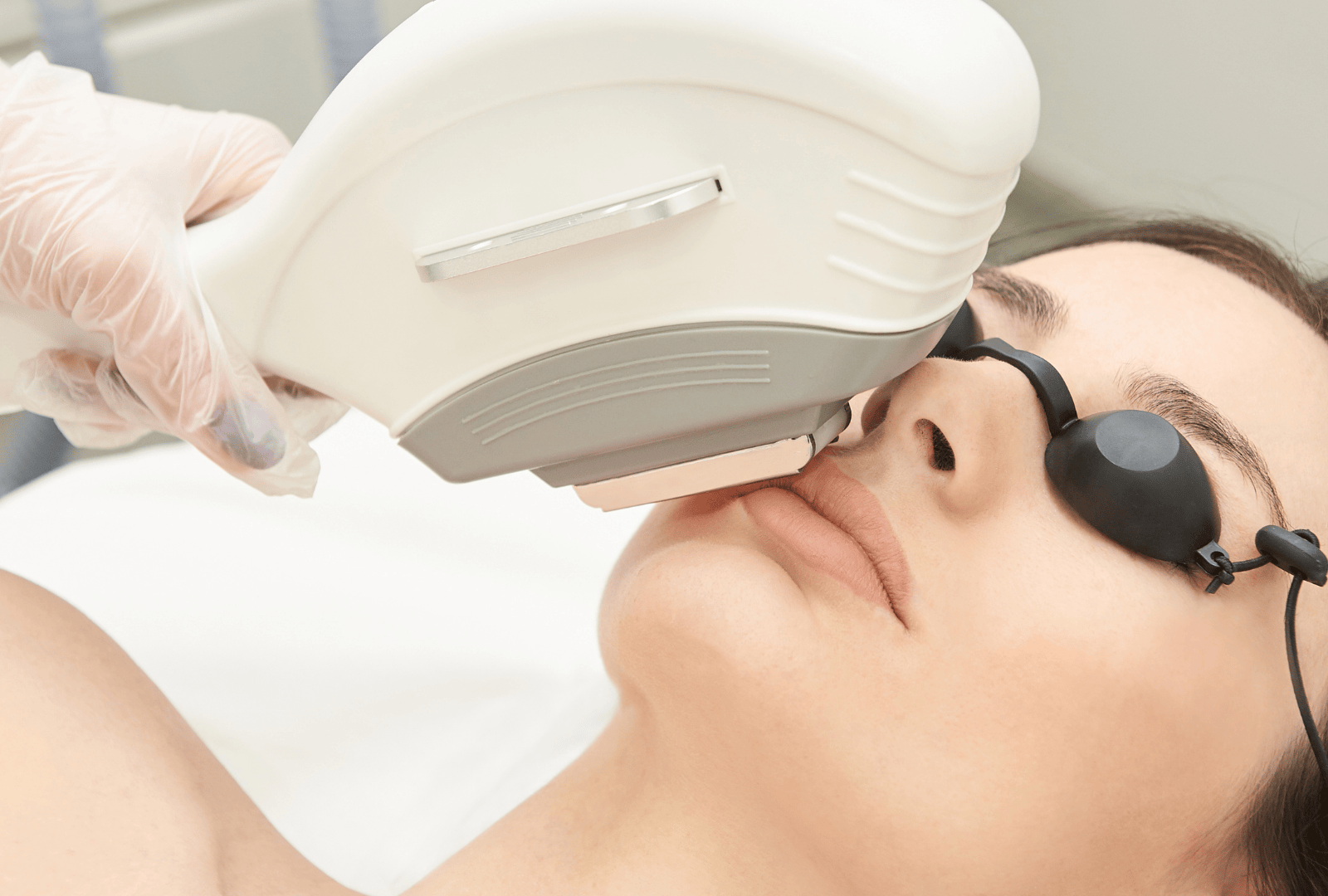IPL PHOTO FACIAL (2)