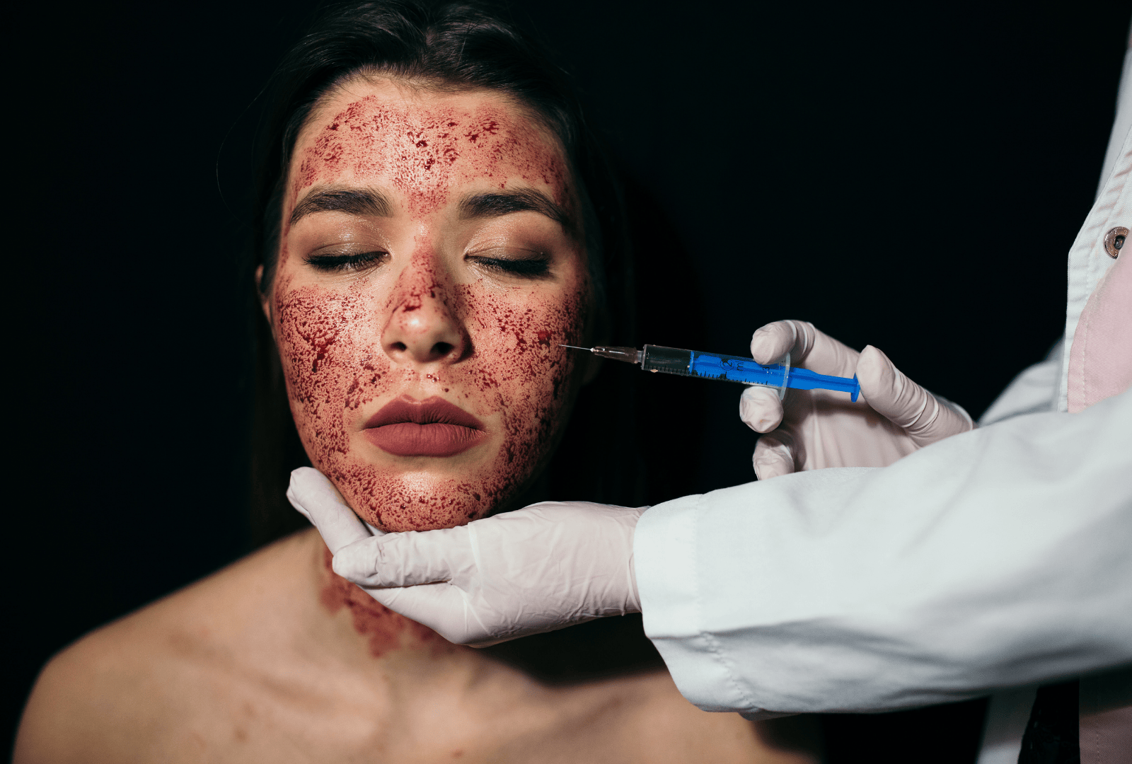 PRP VAMPIRE FACIAL