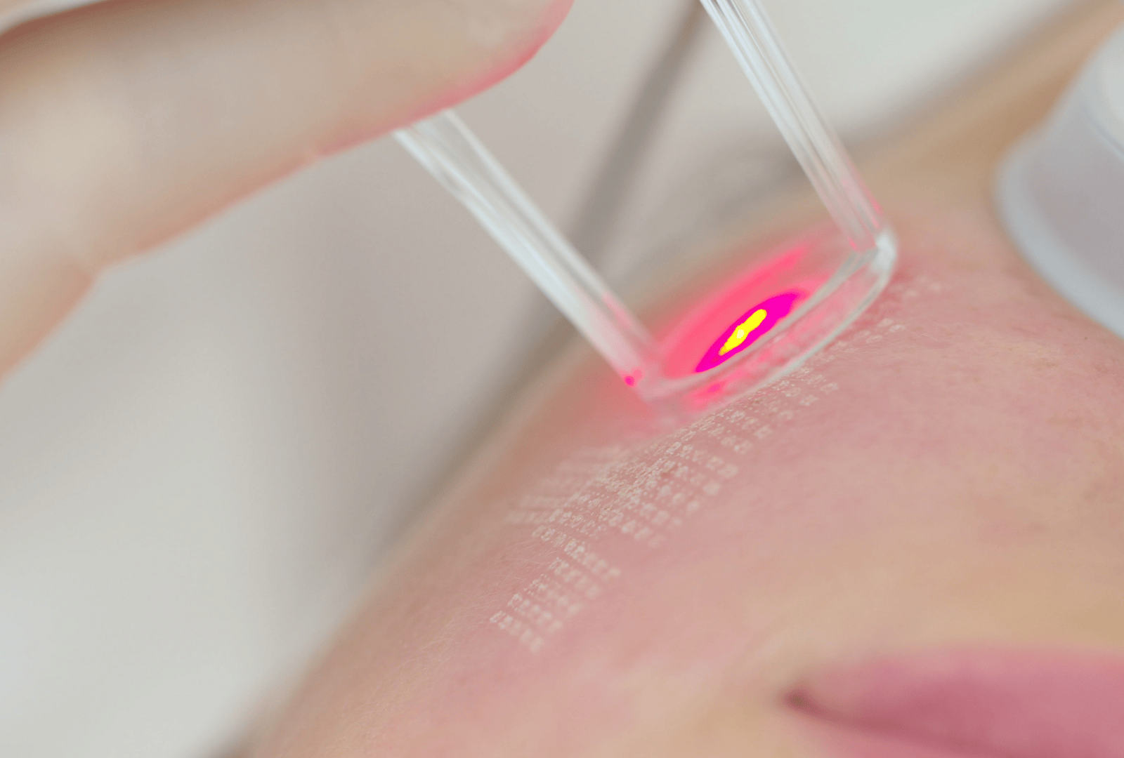 SKIN POLISHING