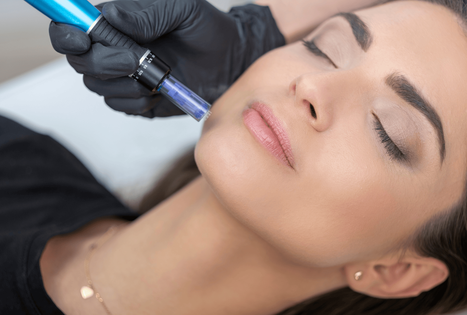 STEM CELL DERMAL THERAPY (11)