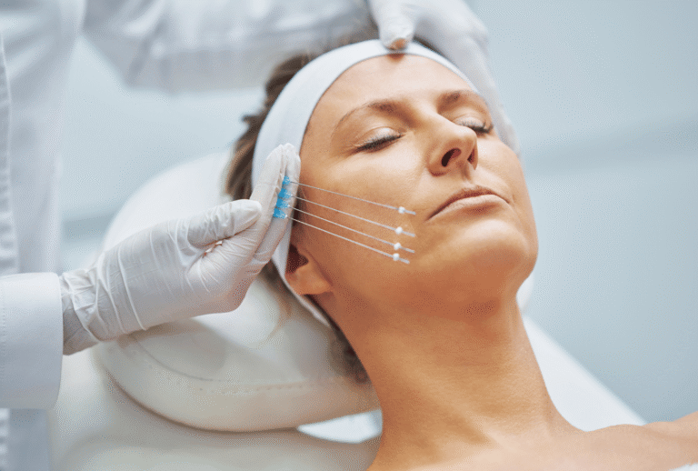 Face Lifting