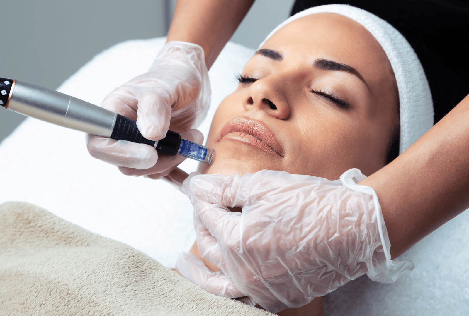 Microneedling & Mesotherapy (2)