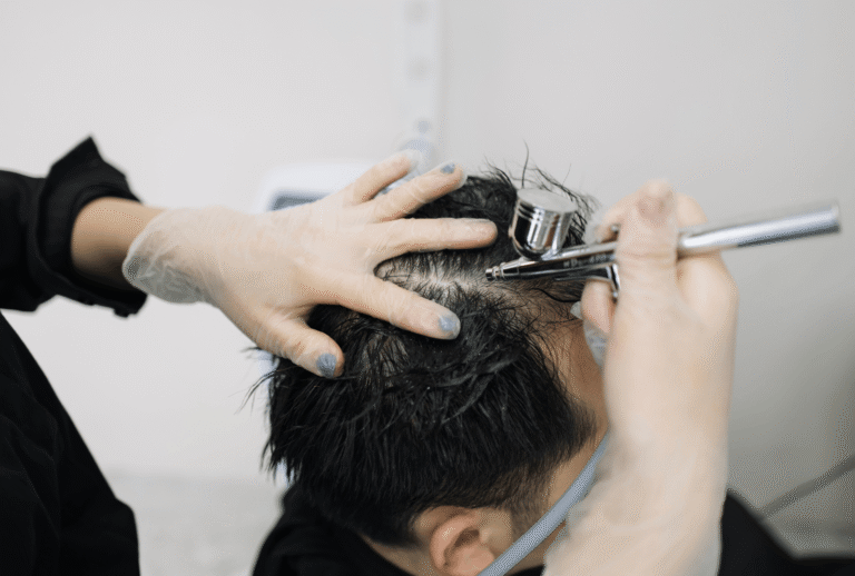 Treatment for hair loss (1)