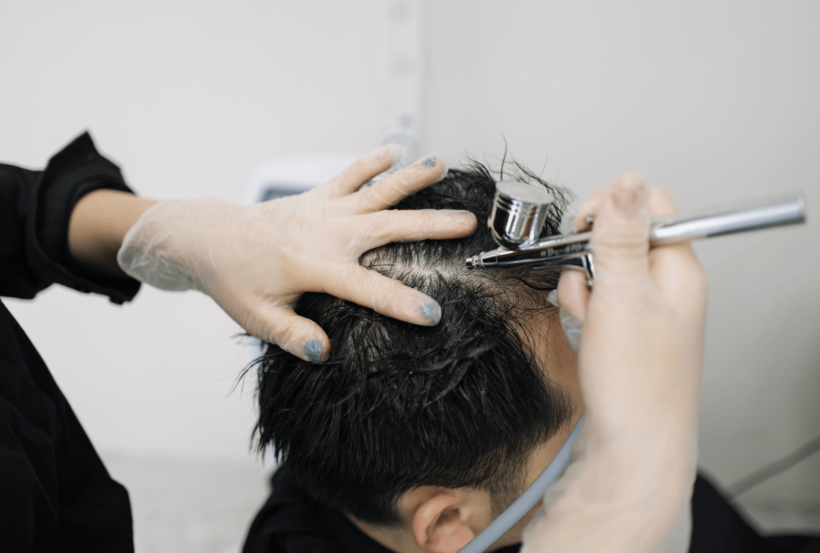 Treatment for hair loss (1)
